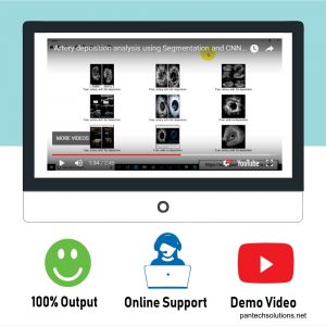 Artery deposition analysis using Segmentation and CNN Classification