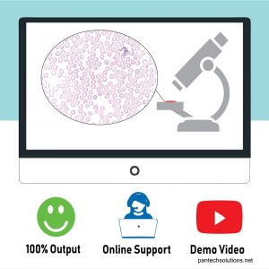 Leukocytes Classification and Segmentation in Microscopic Blood Smear