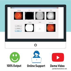 Matlab code for Diabetic Retinopathy using HSV and Fuzzy