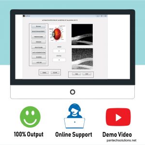 Matlab code for Glaucoma Detection